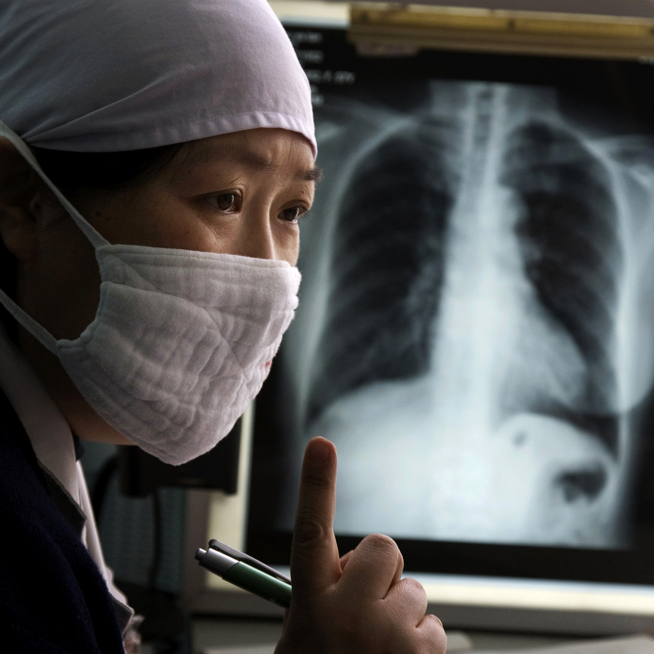 china-tuberculosis